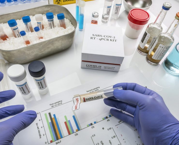 Novel coronavirus 2019 nCoV pcr diagnostics kit. This is RT-PCR kit to detect presence of 2019-nCoV or virus presence in clinical specimens, conceptual image